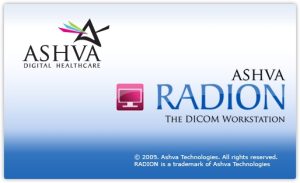 Radion logo